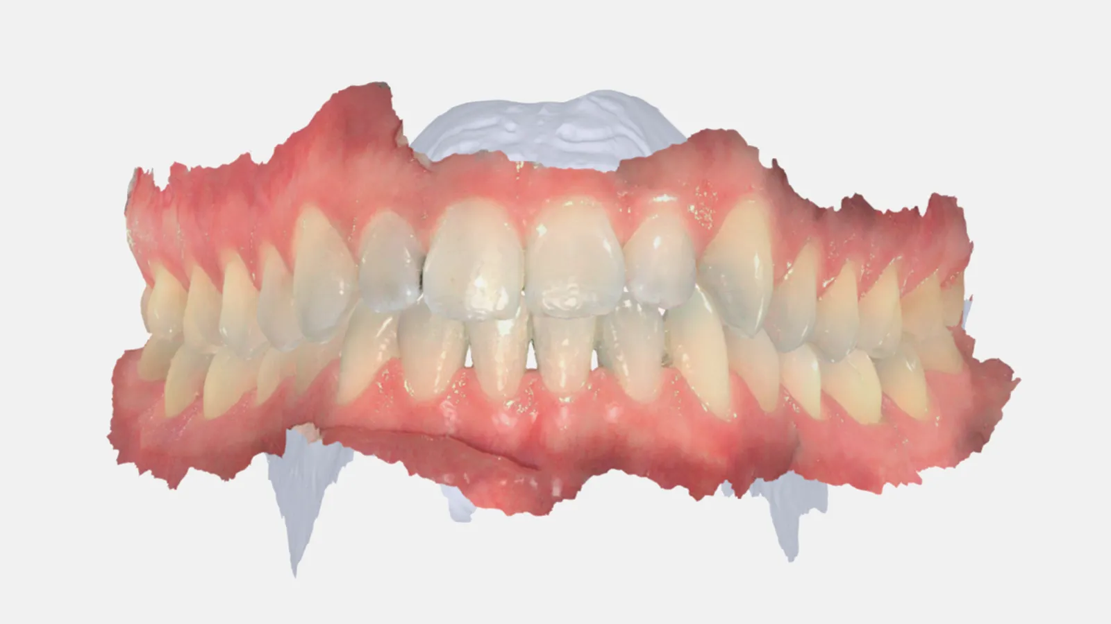Zahnarztpraxis-Jonasch-3D-Scan